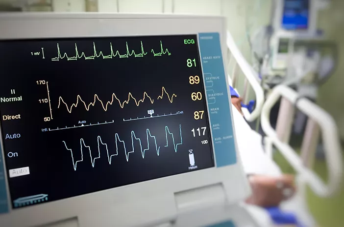 Elektrokardiogram (EKG): Pemeriksaan dan Manfaatnya untuk Jantung
